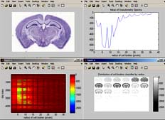 BrainMaps Analyze Screenshot